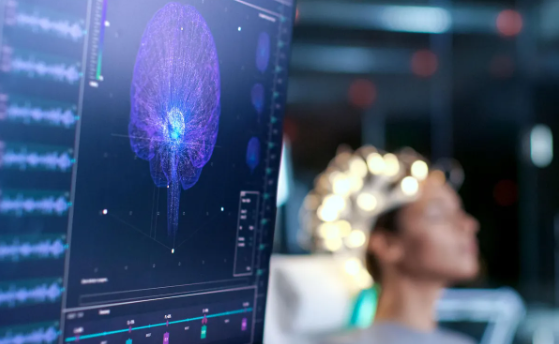 Monitor with brain scan, in foreground woman with electrodes on head in background.
