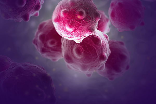 Close-up image of purple cancer cells.
